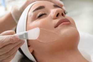 Chemical Peel