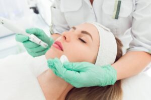 RF Microneedling